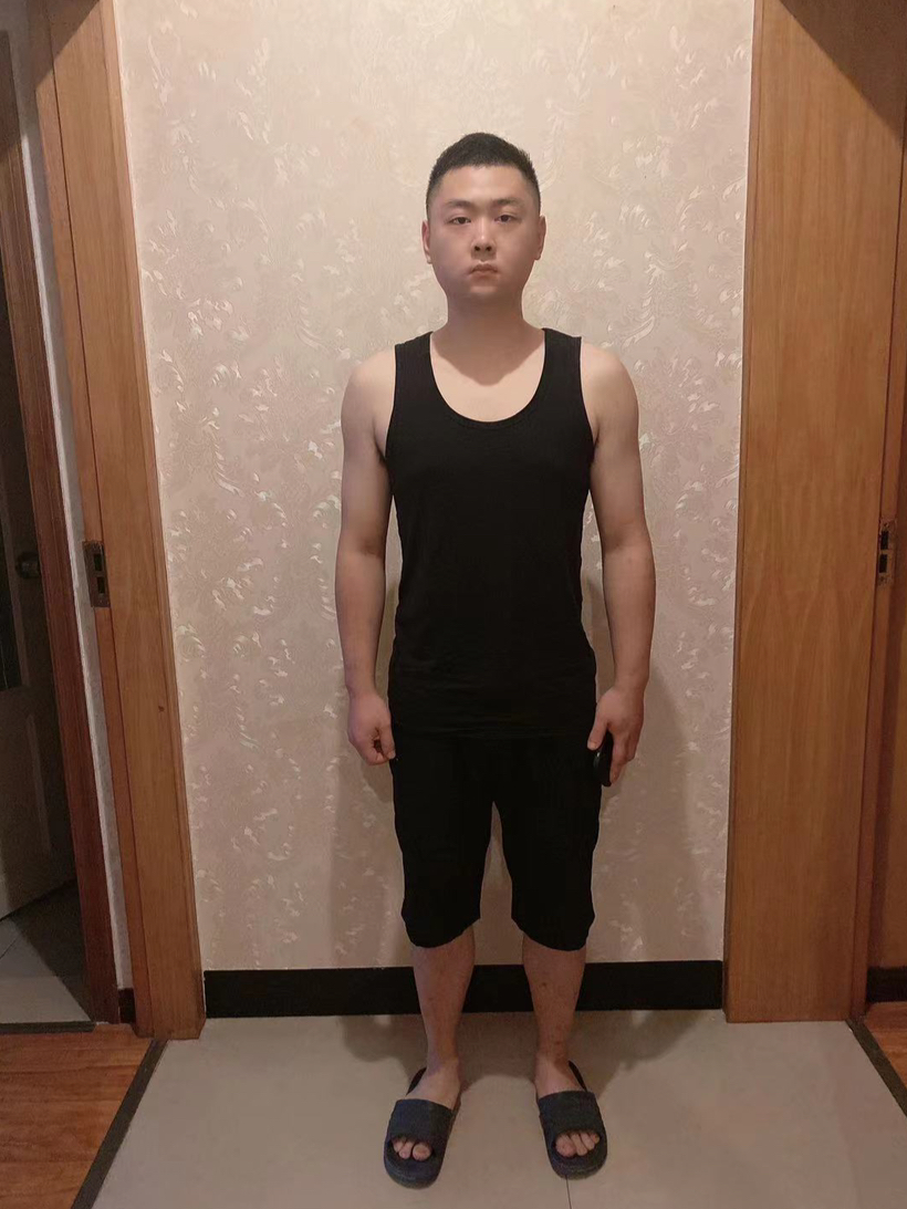 震撼！小伙718.8斤到55天减重230斤，逆袭之路如何走？