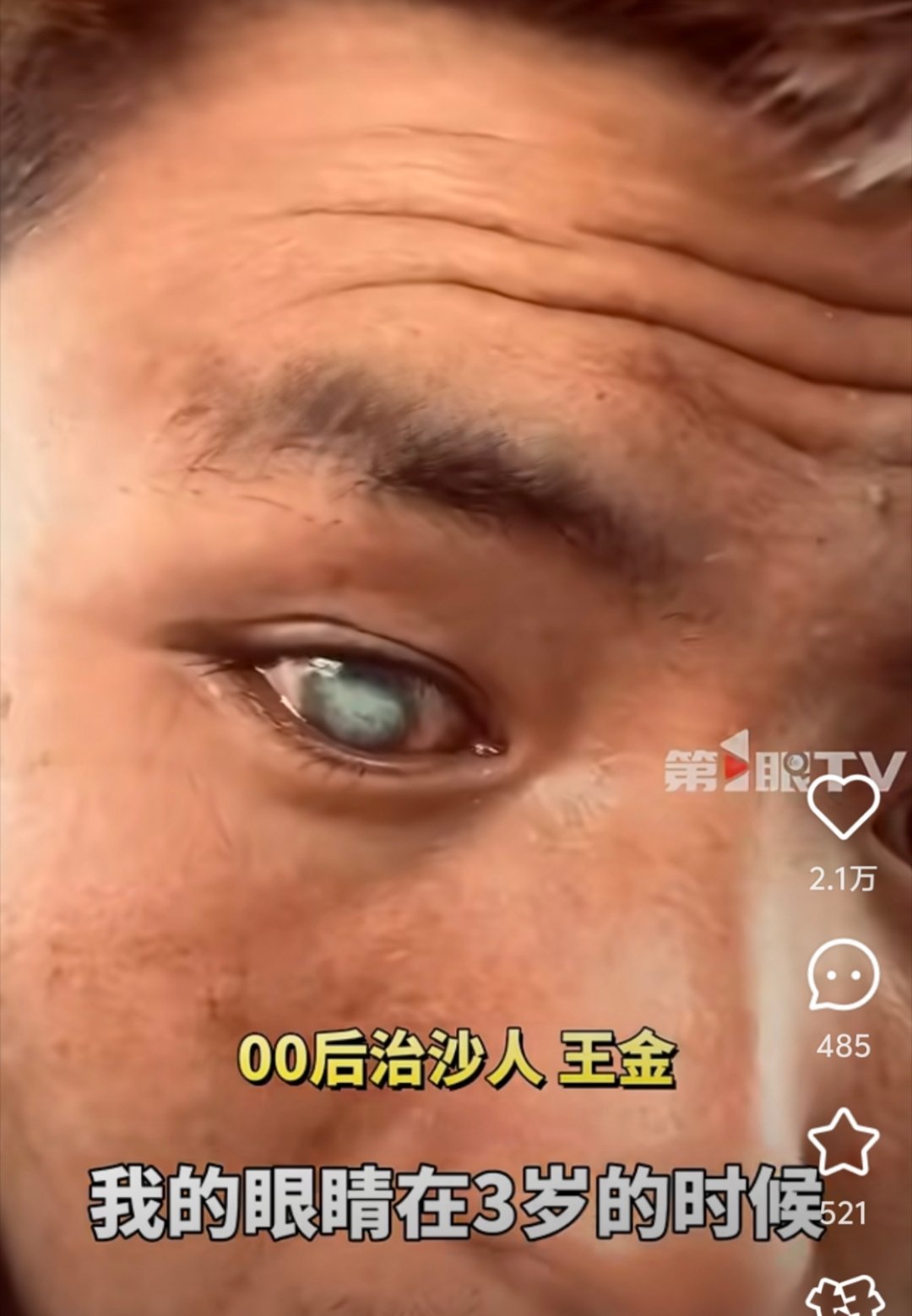 异瞳男生回应不到一个月涨粉200万，现象级网络魅力的揭秘