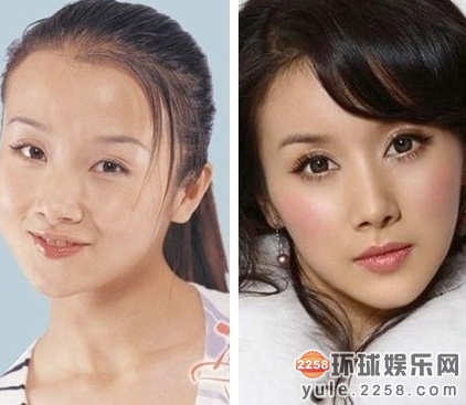 演员孙菲菲回应整容失败事件深度解析